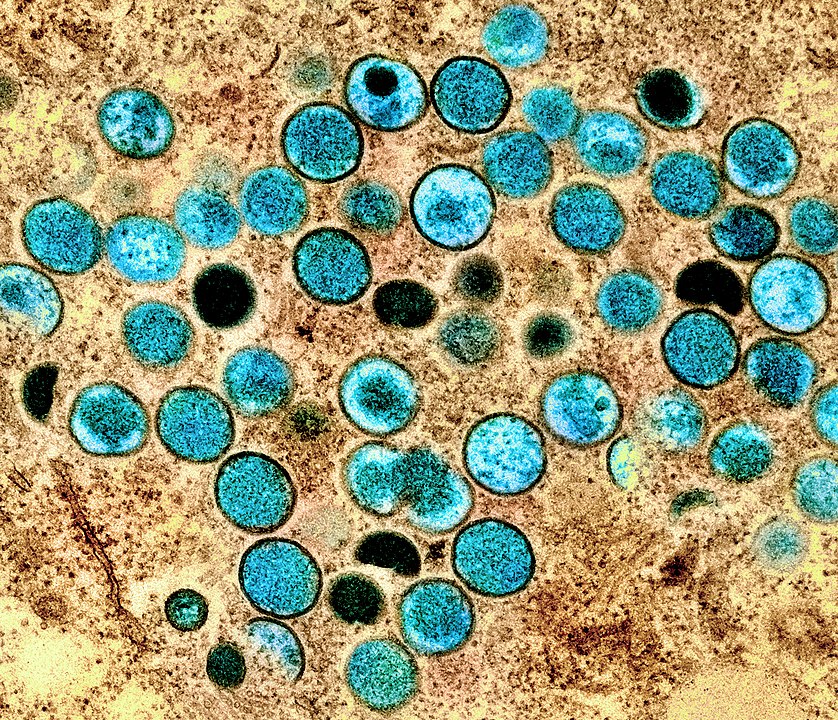 Monkeypox Virus, NIAID